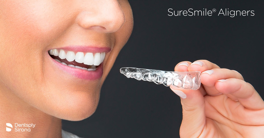 Clear aligners